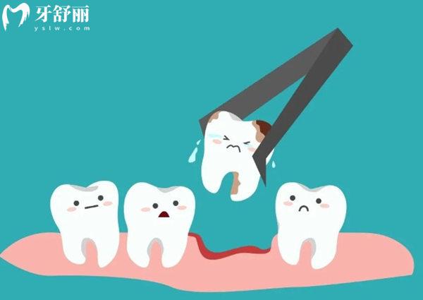 惠州口腔医院拔牙多少钱一颗