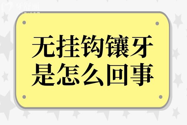 无挂钩镶牙是怎么回事?无挂钩镶牙原理、价格与利弊全解析
