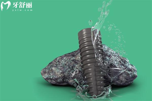 瑞士种植体iti三种档次解析：超全的价格/性能/选择指南快收好