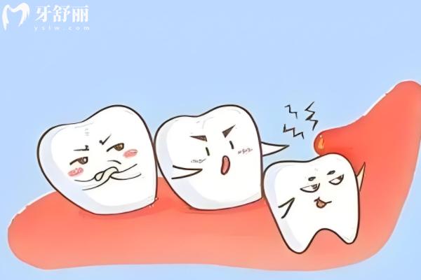 25年深圳口腔拔牙收费标准