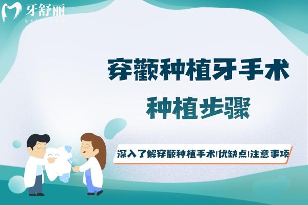 深入了解穿颧种植手术