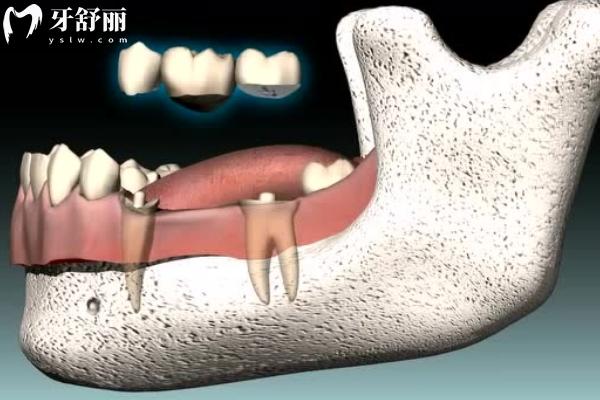 西宁时光诺贝尔口腔收费标准更新