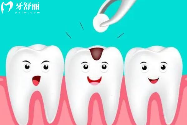 惠州补牙多少钱一颗？