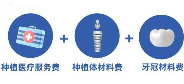 做一颗种植牙包含哪些费用