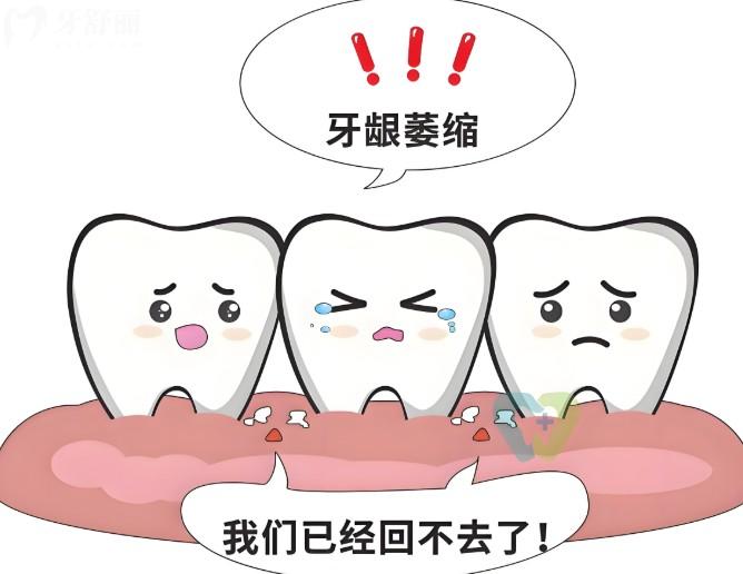 什么是牙龈萎缩