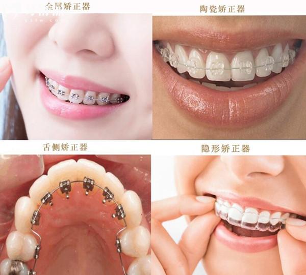 汕头口腔医院2025年收费价目表:种植牙/正畸/镶牙/补牙多少钱一目了然