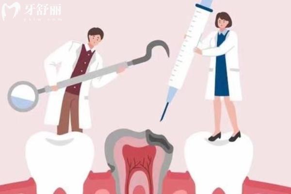 广州哪家医院补牙便宜又好？