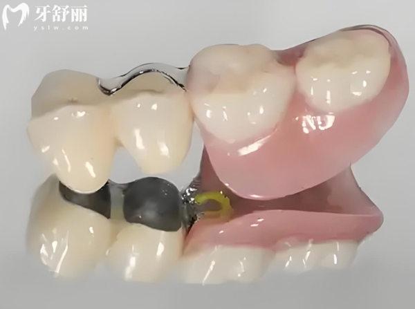 兰州口腔医院收费价目表