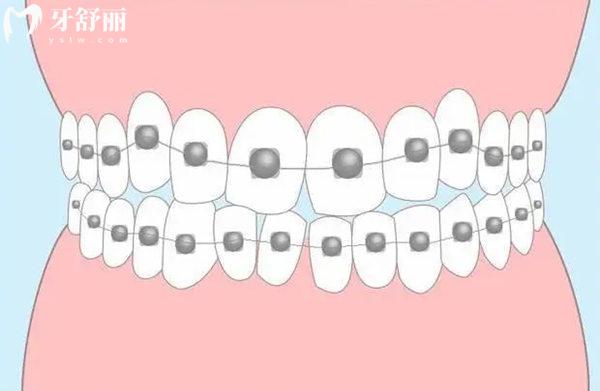上海薇琳伯曼口腔牙齿矫正