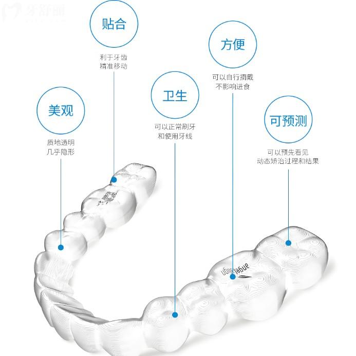 时代天使隐形牙套