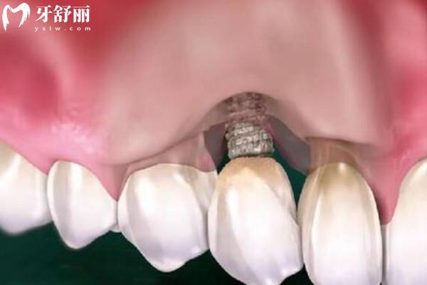 延吉韩世口腔医院是正规医院吗