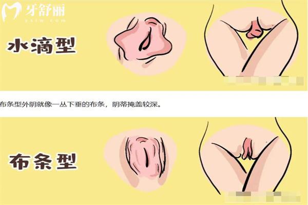 私处花型哪种好看 盘点二十四种b型状照片,常见馒头形/蝴蝶形/哪种好看