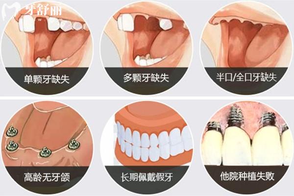 徐州种牙费用大概多少钱