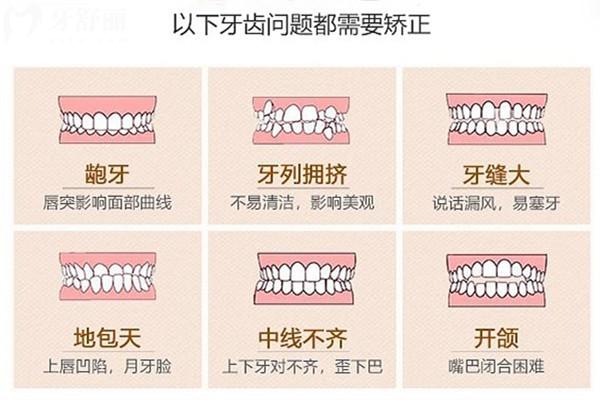 悦见隐形矫正