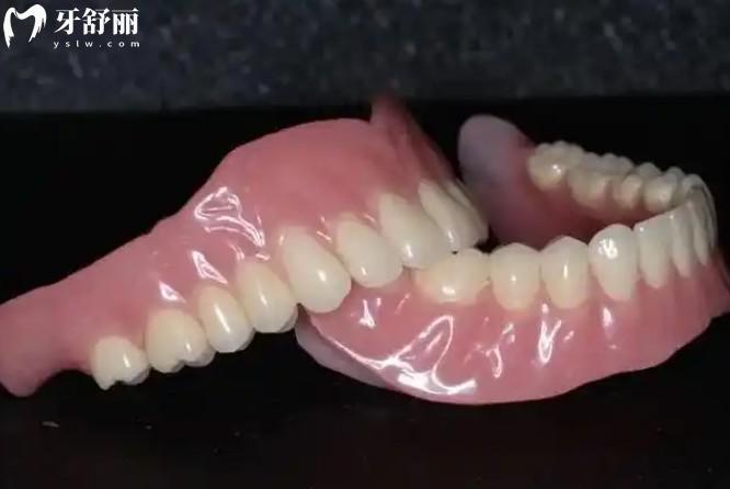 选吸附性义齿怎么避坑