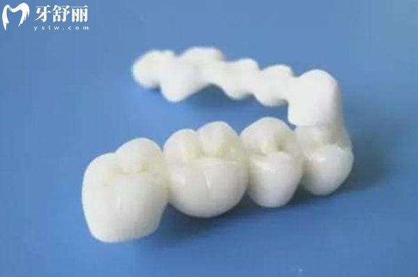 爱迪特VS爱尔创全瓷牙哪个质量好