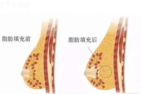 2025深圳艺星医疗美容价格表