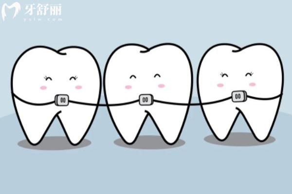 洛阳哪里矫正牙齿比较好