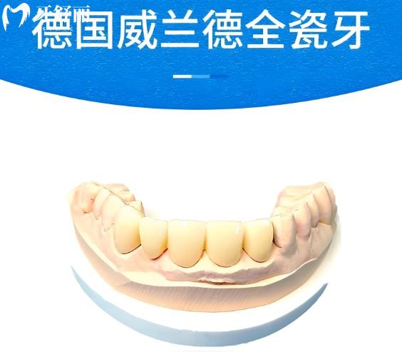 威兰德牙冠