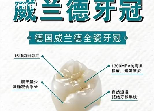 威兰德牙冠有哪些型号