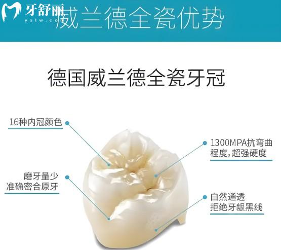 威兰德牙冠有哪些型号