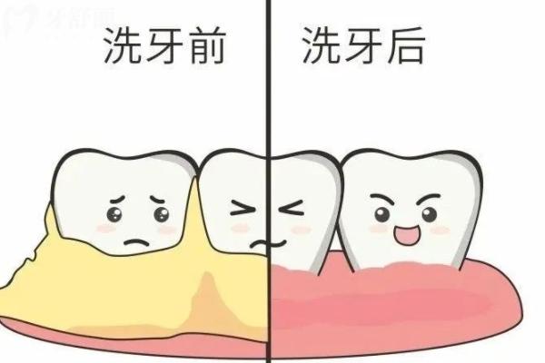 咸阳洗牙哪家医院好？