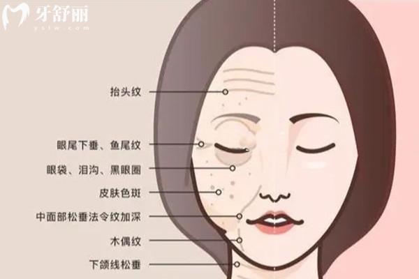全脸微调大概需要多少钱