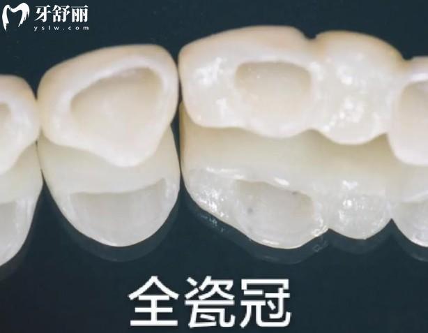 爱尔创水晶锆和二氧化锆区别对比