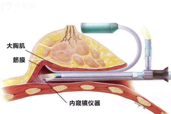 上海隆胸医生前十名