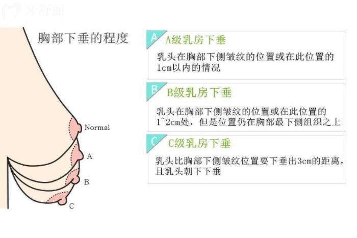 上海隆胸医生前十名