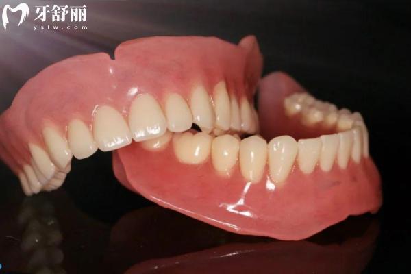 半口吸附式义齿多少钱?