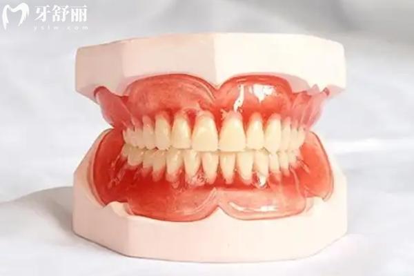 半口吸附式义齿多少钱?