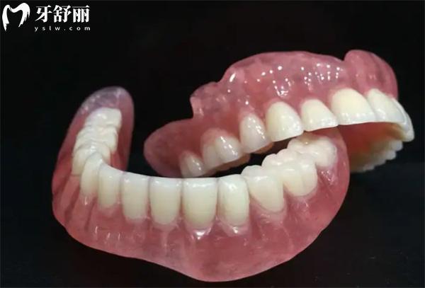 广州吸附性假牙价格多少钱