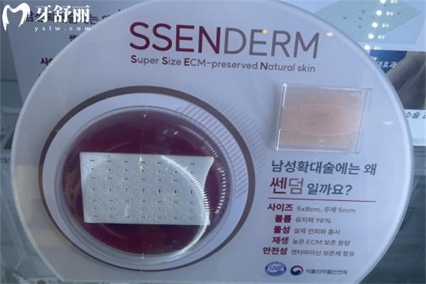 生物补片增粗可靠吗?通过术后<span style=