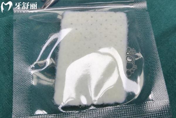 生物补片增粗靠谱吗