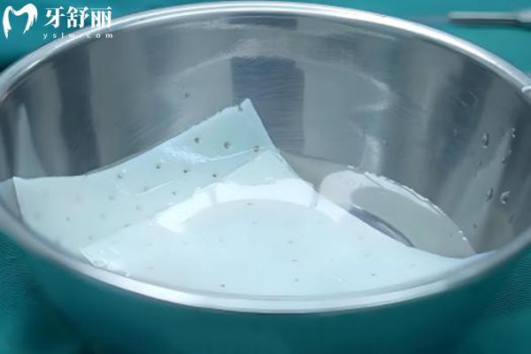 生物补片增粗靠谱吗