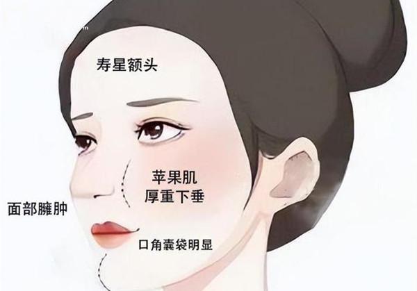 馒化修复收紧针多少钱一针