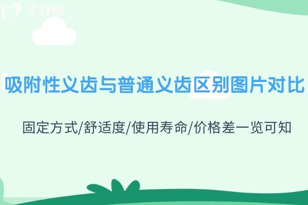 吸附性义齿与普通义齿区别图片对比:固定方式/舒适度/使用寿命/价格差一览可知