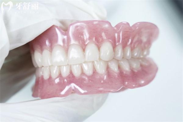 吸附性义齿与普通义齿区别图片对比:固定方式/舒适度/使用寿命/价格差一览可知