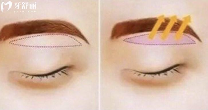 上海眼修复好的医生名单