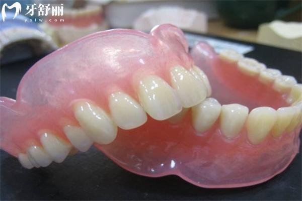 广州镶全口假牙多少钱