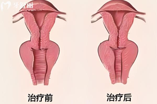苏州打紧缩针的医院哪家好？