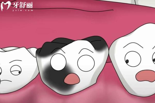 东莞比较出名的牙科医院排名:莞大/好佰年/国贸/固德收费不贵技术贼好