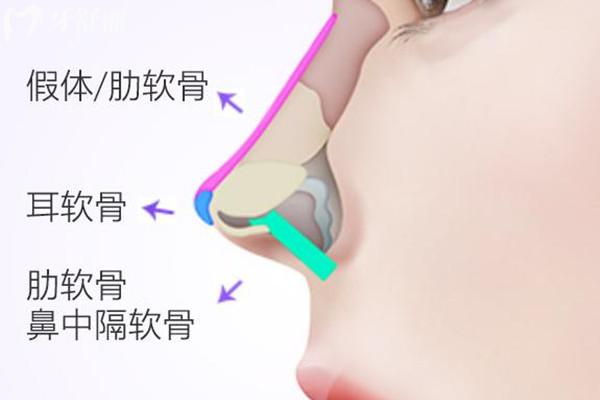 上海直鼻做得好的医生排名榜