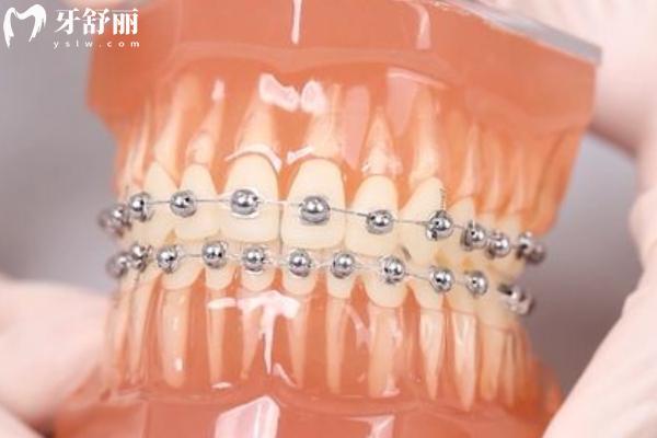 楚雄牙科矫正医院哪家比较好