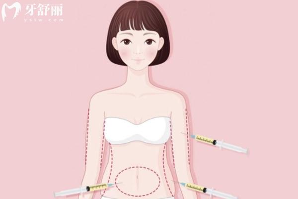 2025南京吸脂价格表