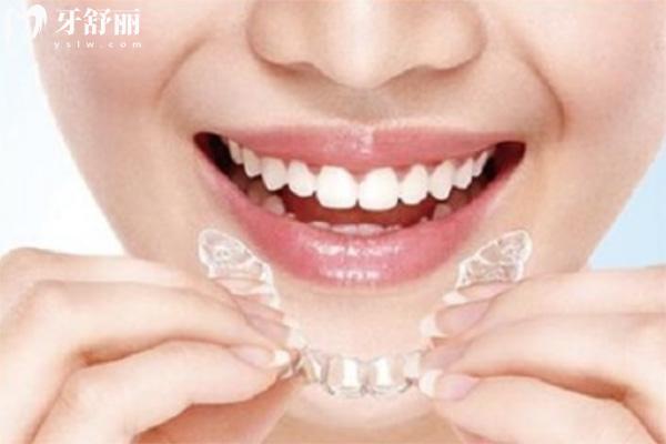 苏州牙齿矫正哪个医院好