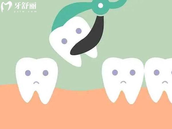 超声骨刀拔智齿和传统拔智齿哪个好?介绍这两者的区别/优缺点/价格