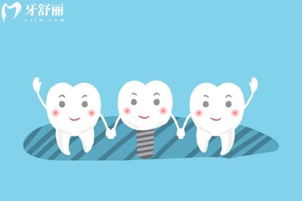 瑞典astra和瑞士iti种植体哪个好
