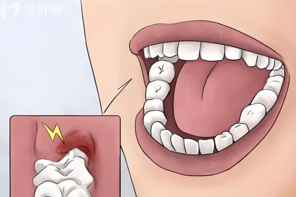 成都拔牙多少钱一颗